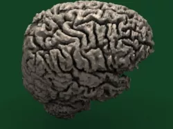 Human Brain