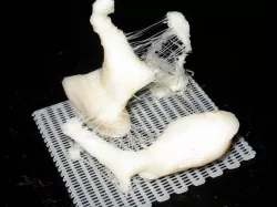 Human ossicles (ear bones) ~10X