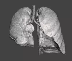Human lungs DEMO 3D model