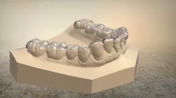 3D Digital B Splints  3D print model