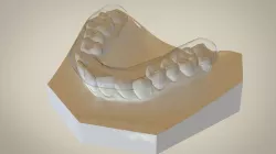 Digital Flat Plane Splint Orthodontics 3D print model