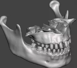 Human maxillary and mandibular jaws with typodont  3D print model