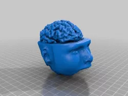 Brain and head