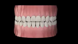 teeth 3D model