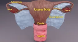 Uterus 3D model