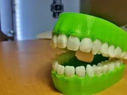 Chattering teeth remix -added support to the bridge