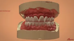 Digital Full Dentures for 3D Printing and Milling 3D print model