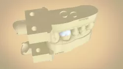 Digital Dental Quadrant  Model with a Full Contour Crown 3D print model