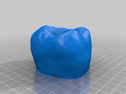 Molar 16 (Human teeth)