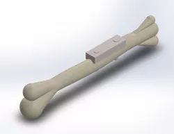 Bone Implant