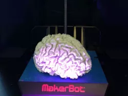Brain