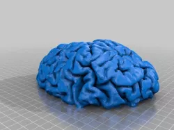 Cerebro