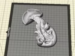 Kidney