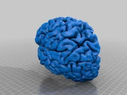 Human Brain