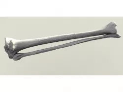 Human Tibia and Fibula