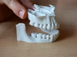 CT teeth
