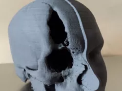 Dissected Head / Skull MRI Scan