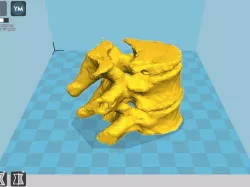 Vertebra