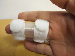 Férula de dedo/Finger Splints