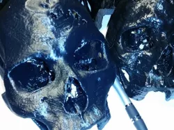 Human Skull Scan