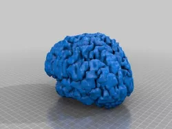 My Brain