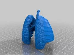 Lungs