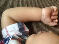 Toddler arm for Kaic 1 year old
