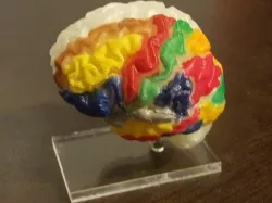 My own brain (simple version)