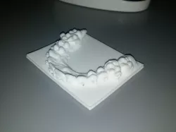 Teeth With Braces