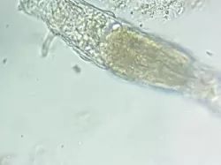 phone microscope adapter