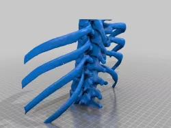 Lower Spine and Ribcage from Chest CT