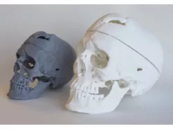 Skull of Phineas Gage