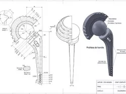 Prosthetic hip joint
