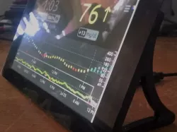 Raspberry Pi 7” Touchscreen Display Legs