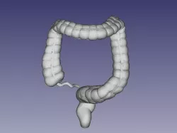 large colon