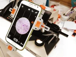 Universal Smart Phone Microscope Mount Remix