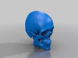 Anonymous CT Skull 3