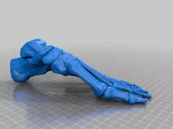 Bone - Foot - Left