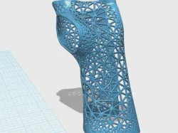 wrist - hand -splint