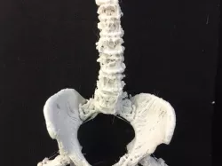 Spine and Pelvis from CT Scan