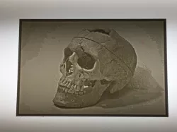 Phineas Gage Skull- Lithopane