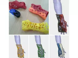 CRE-001 3DCast for Fixation - Huced Despro ITS