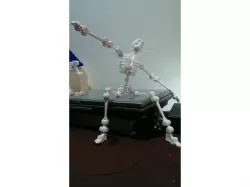 robot about the bone collector