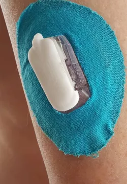 Dexcom G5 Transmitter battery cover