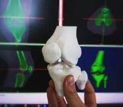 Knee (from CT scan)