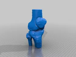 knee joint 