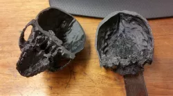 Skull CT Scan 