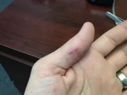 3D Printer Battle Wounds
