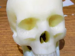 Skull