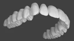 Upper jaw teeth anatomy 3D model